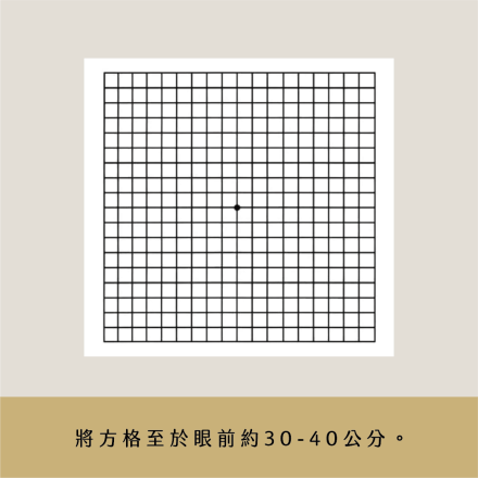 梵谷與黃斑部病變