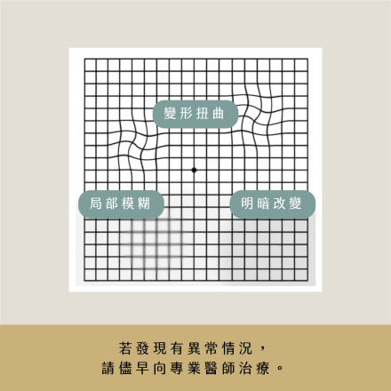 梵谷與黃斑部病變
